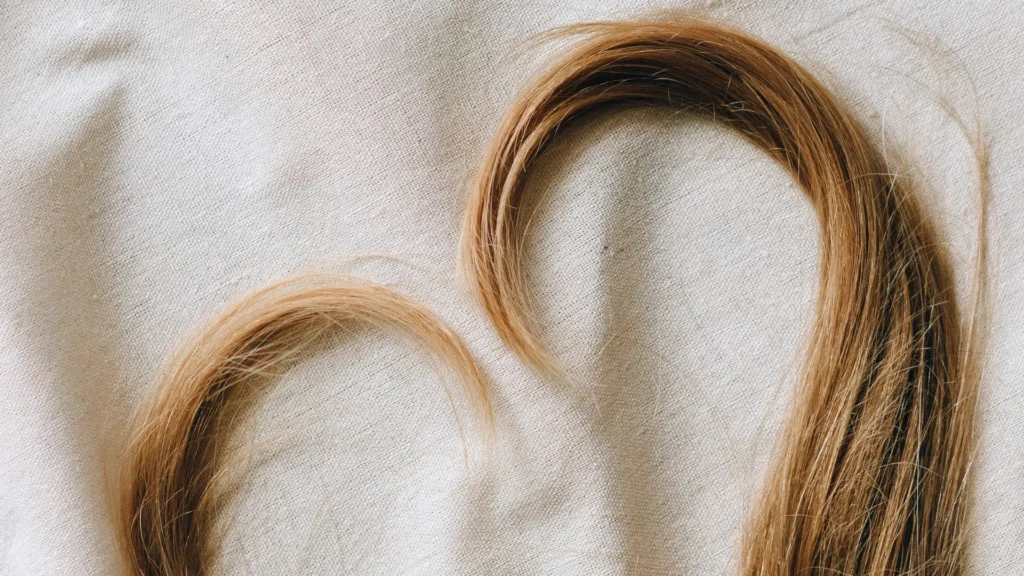 Key Trends Driving Hair Restoration in 2025