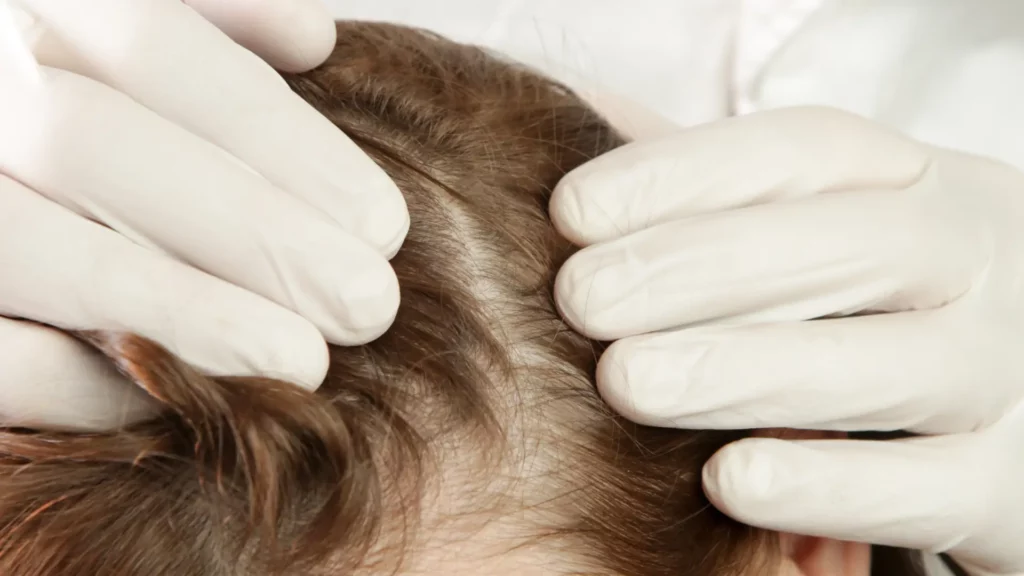 compromised scalp health