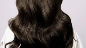 Hair Transplant Recovery Timeline