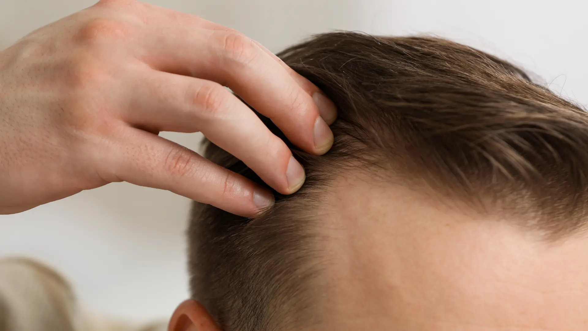 Hairline Symmetry Science: Achieving Balance for a Perfect Hairline
