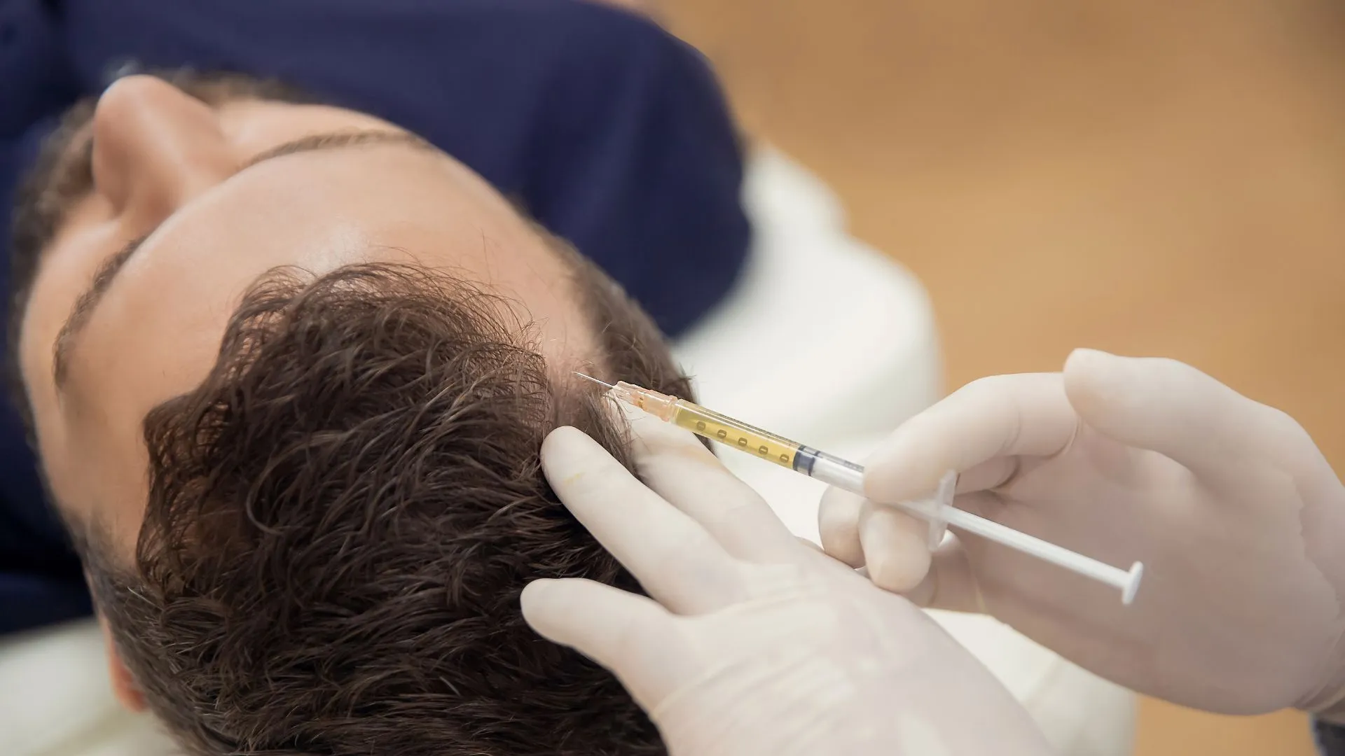 prp hair loss treatment