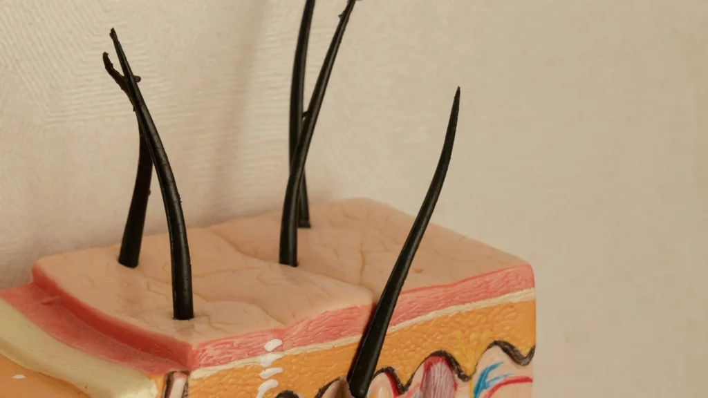 Hair follicle regeneration