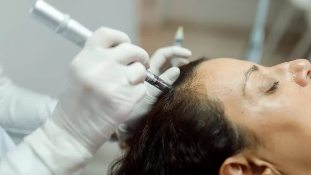Hairline Design