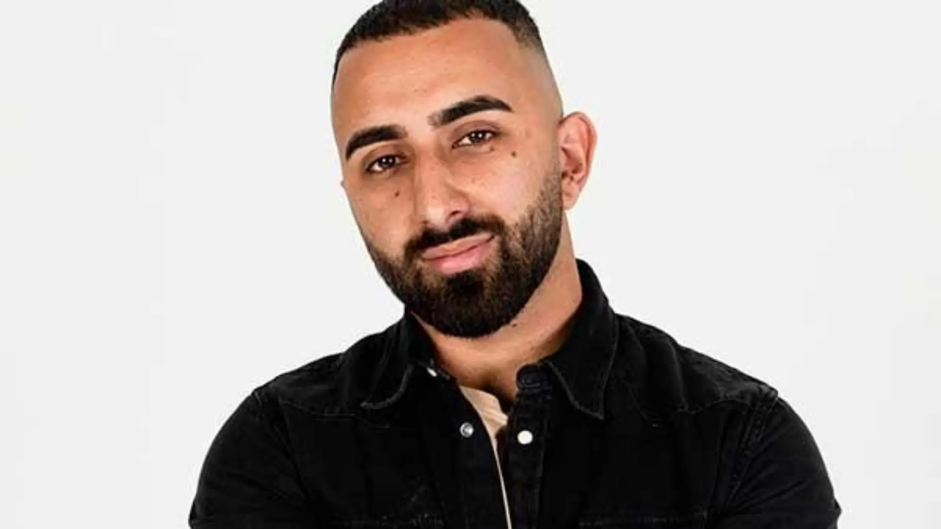 ibby akbar hair transplant news
