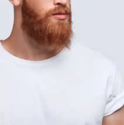 Facial-Hair-Transplant