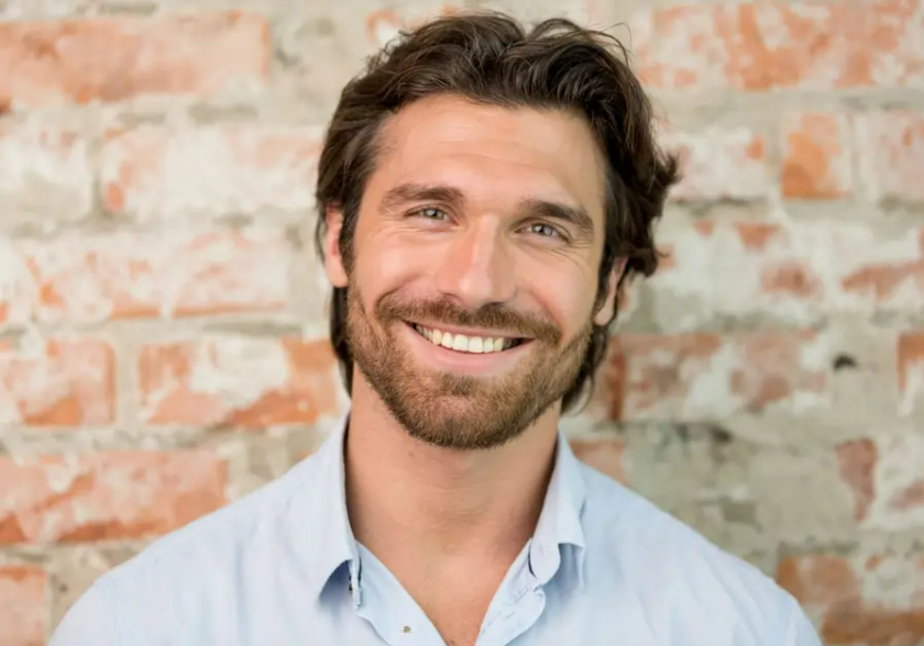Facial Hair Transplant