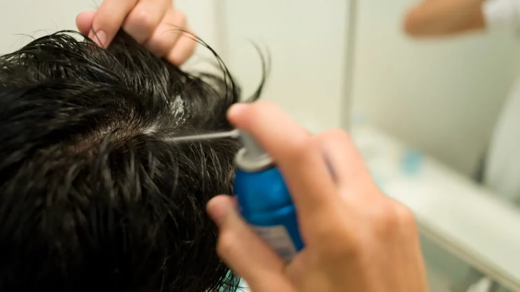 Psychological Benefits of Hair Restoration