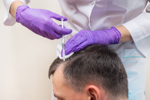 Hair Transplant Procedure