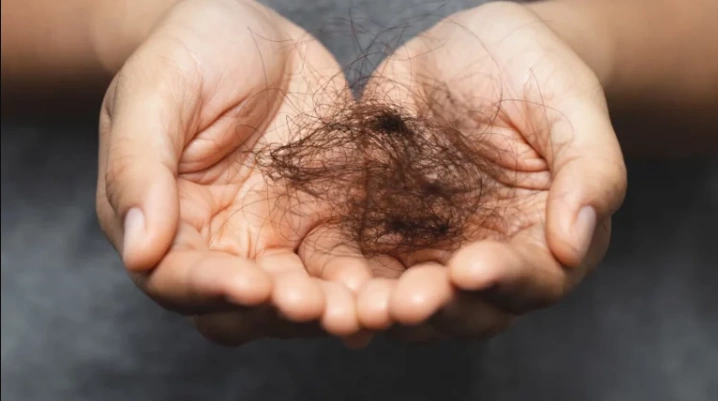 Is Poland a Good Destination for a Hair Transplant? Is Poland a Good Destination for a Hair Transplant?