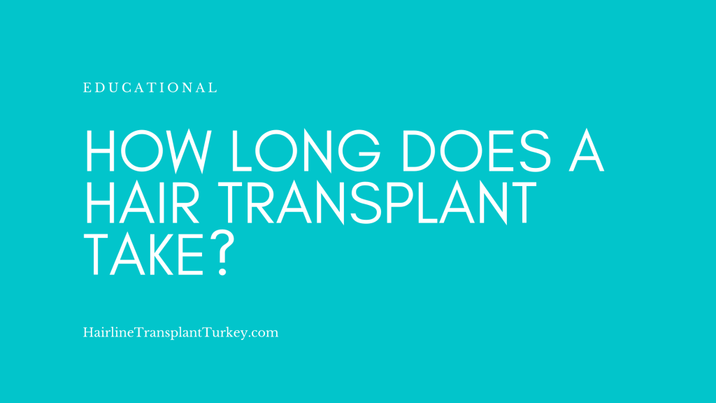 How Long Does a Hair Transplant Take