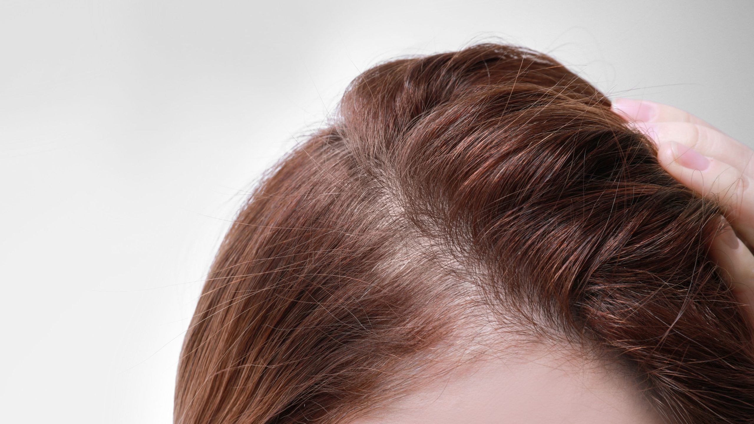 Hair Transplant for Long Hair