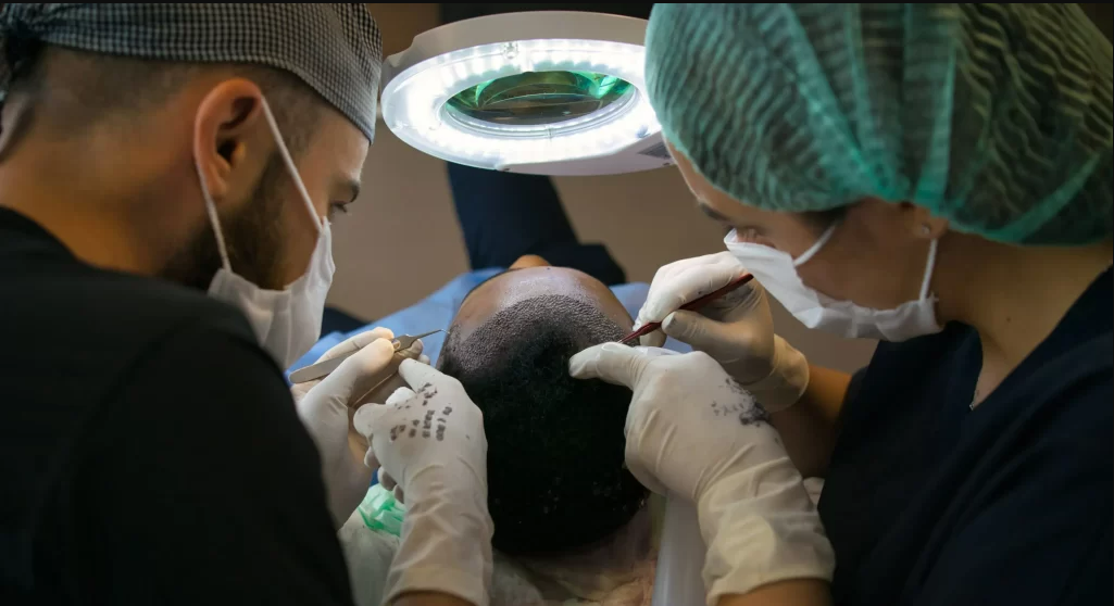 hair transplant ugly duckling phase hair transplant ugly duckling phase