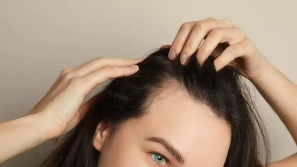How Do You Know You Have a Receding Hairline How Do You Know You Have a Receding Hairline