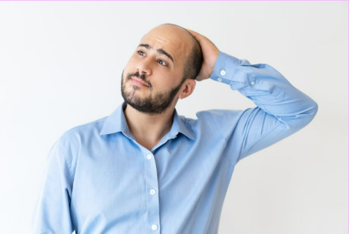 Man with hair loss wondering what to look for when choosing a hair transplant clinic in Turkey