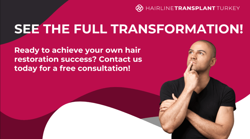 Get your consultation for free - Hairline Transplant Turkey
