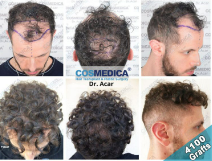 Cosmedica Before and After