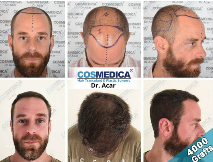 Cosmedica Before After Pictures