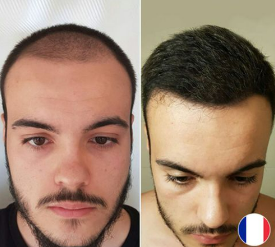 hairexpert clinic review