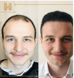 Med Me Hair Clinic