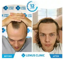 Lenus Clinic BA2