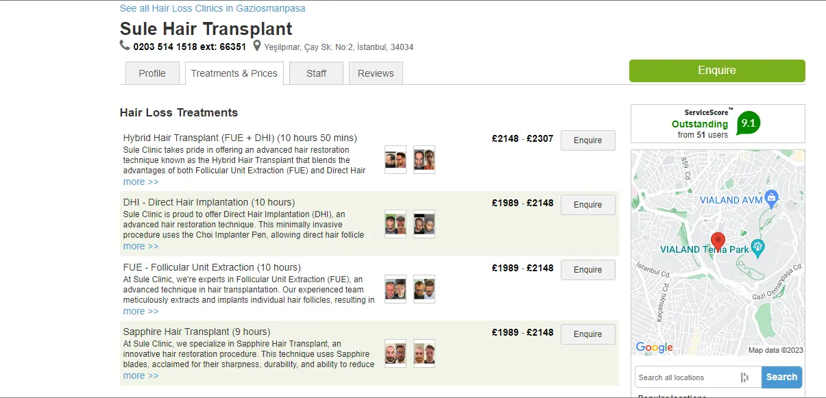 Sule Hair Transplant Price